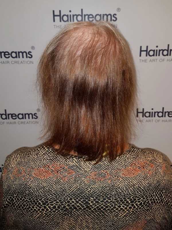 hairdreams-haarverdichtung-microlines-after-4-2